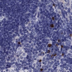 FRMD1 Antibody, Novus Biologicals 25 &mu;L | Buy Online | Novus Biologicals | Fisher Scientific